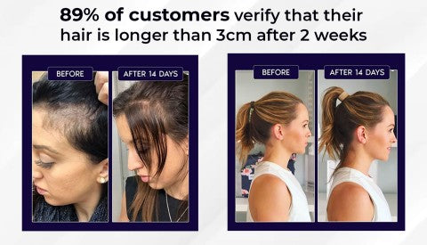 đż HZA⢠Natural Hair Regrowth Spray â 70% OFF Ends Tonight!