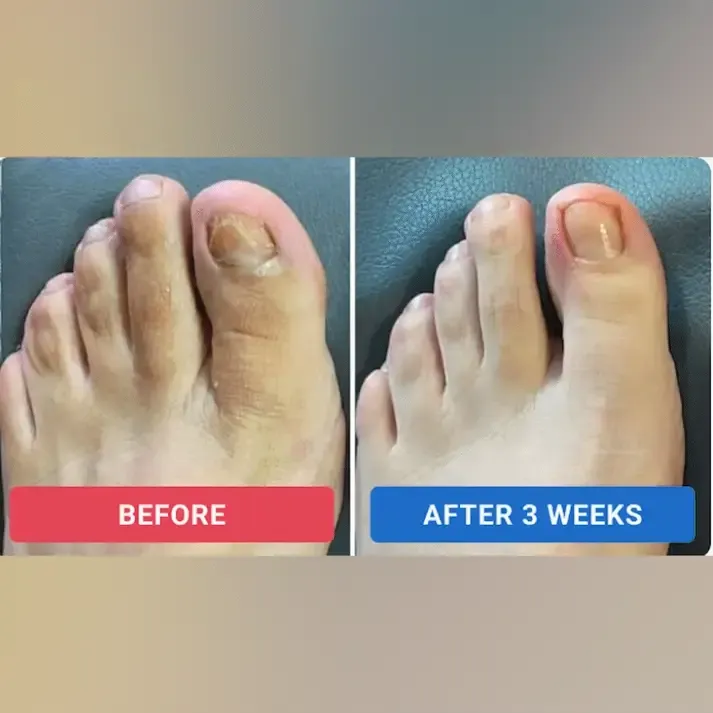 Nails Acting Up? Vaxflite™ Patches Fix the Damage Without the Drama.