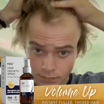 đż HZA⢠Natural Hair Regrowth Spray â 70% OFF Ends Tonight!