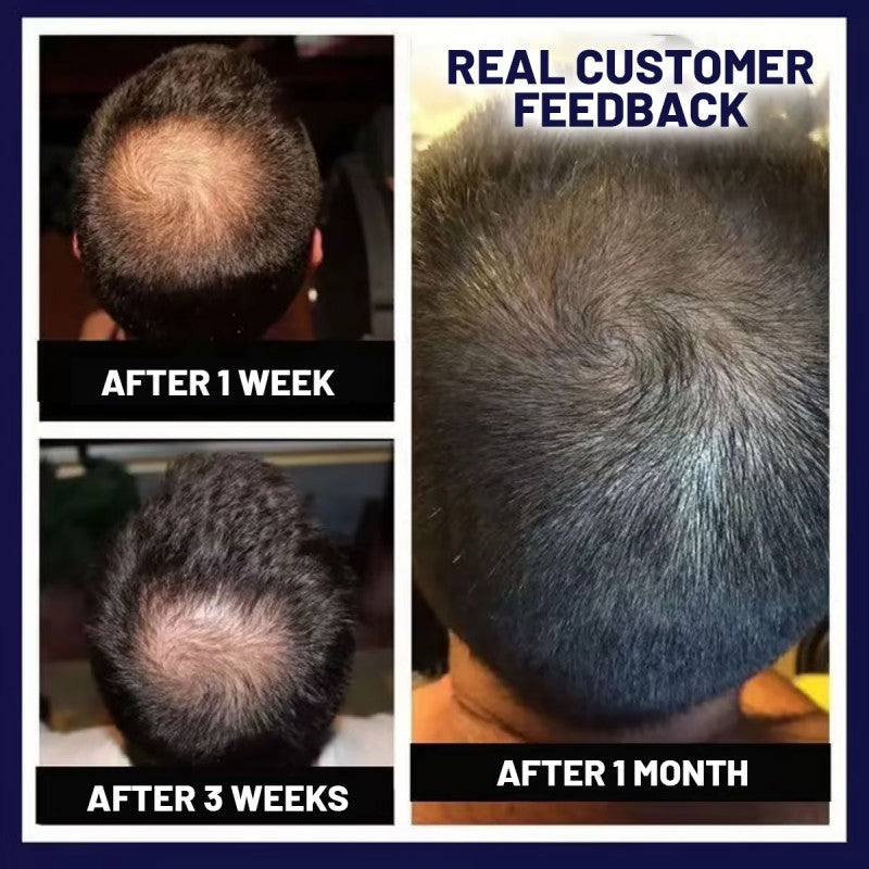 đż HZA⢠Natural Hair Regrowth Spray â 70% OFF Ends Tonight!