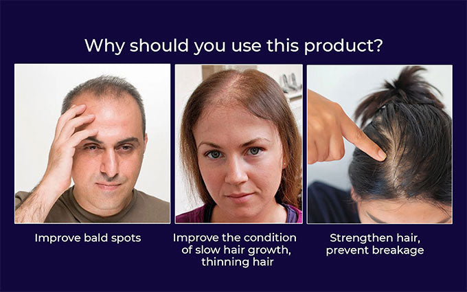 đż HZA⢠Natural Hair Regrowth Spray â 70% OFF Ends Tonight!