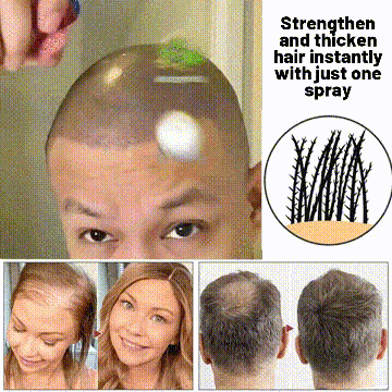 đż HZA⢠Natural Hair Regrowth Spray â 70% OFF Ends Tonight!