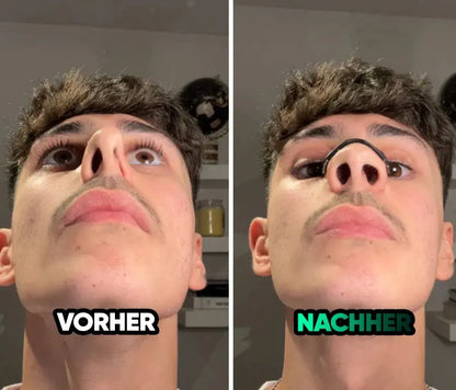 LOVILDS™ Magnetic Nose Patch – Breathing Expander Keeping You Breathing, Naturally.
